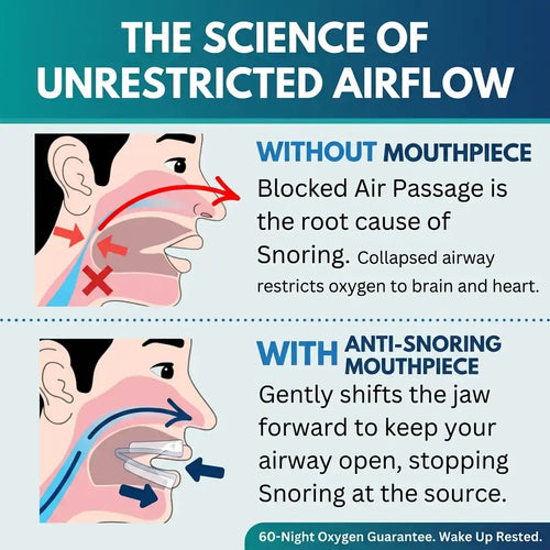 Anti-Snoring Mouthpiece